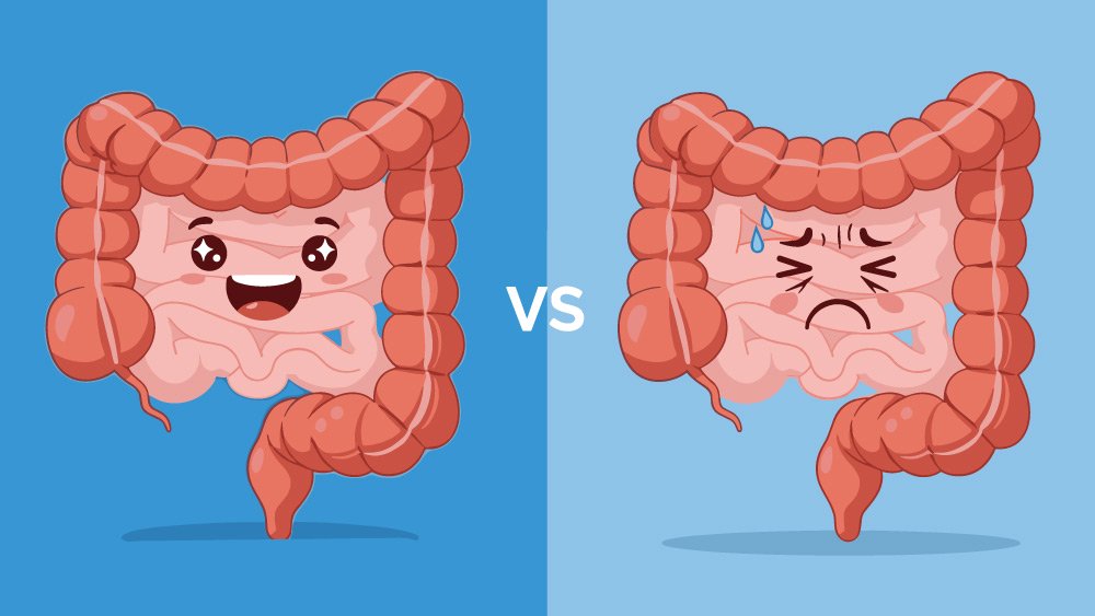 Quando la fibra non basta per il transito intestinale