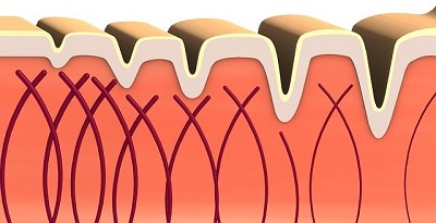 Pelli miste e grasse